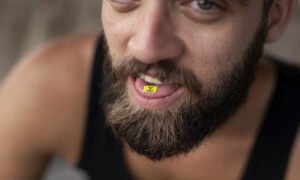 Can You Overdose On Lsd